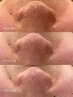 ご褒美エステ体験♪毛穴レスの美肌へ…¥9,900♪