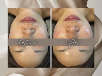 ゴールデンケア(goldencare)/【左右差】がお悩みでした!!!