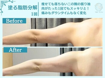 フローフシ∞/【痩身】塗る脂肪分解&燃焼