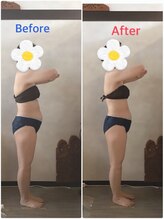 ソレイユ/インディバで血行促進