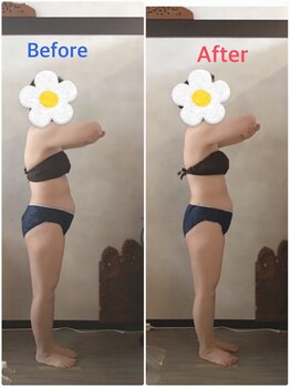 ソレイユ/インディバで血行促進