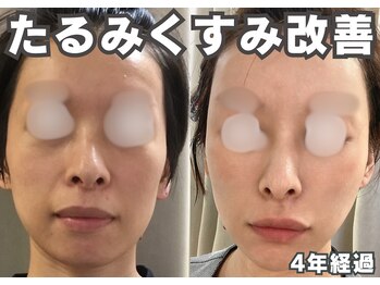 フェイス(FACE)/エステ&ホームケア経過