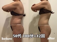 エステティックサロン フェアリー(ESTHETIC SALON FAIRLY)/痩身＊サイズ変化は1回目から！