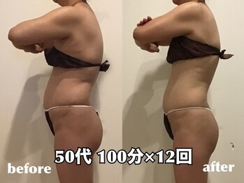 エステティックサロン フェアリー(ESTHETIC SALON FAIRLY)/痩身＊サイズ変化は1回目から！