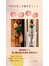 ヨサパーク ふわり/