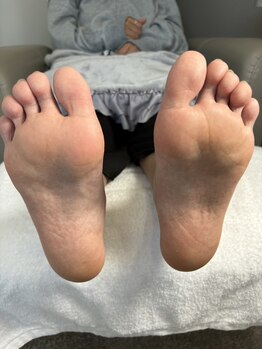 リンネ(Rinne)/角質ケア