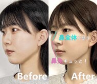 隆鼻矯正専門店 ラプリセレネ (Raplit Selene)