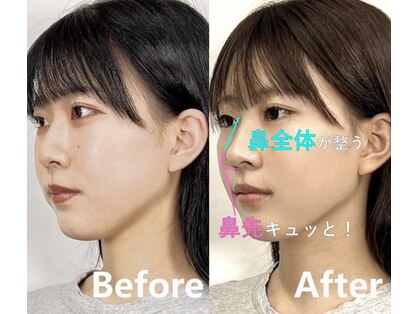 隆鼻矯正専門店 ラプリセレネ (Raplit Selene)の写真