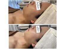 ルヴェール 久屋公園(le verre)/男性にも人気！ララピール