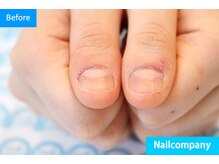 ネイルカンパニー/