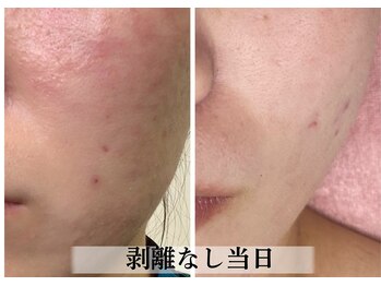 ラビエス(LAVIES)/【20代】夜勤で揺らぐ肌