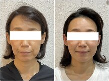 美容整体ウェリナ あま甚目寺院/小顔矯正/骨盤矯正/美脚サロン