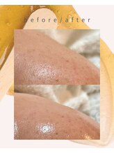 ウララカ(uraraca)/一度でも変わる