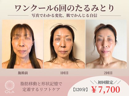 オラ(Ola)の写真