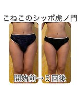 こねこのシッポ 虎ノ門/大人気！下半身コース