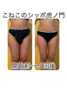 こねこのシッポ 虎ノ門/大人気！下半身コース