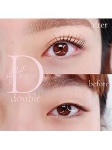 ルークアイビューティ(Luke eye beauty)/ダブルアイリフト