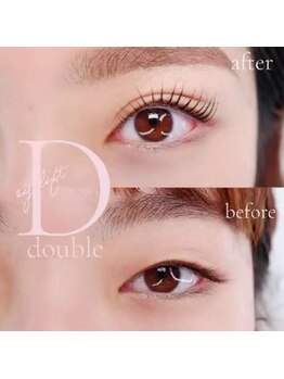 ルークアイビューティ(Luke eye beauty)/ダブルアイリフト