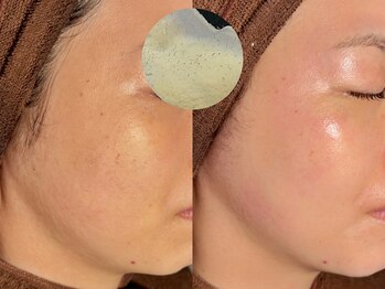 ルーナジェーナ(Luna llena)/池袋 エステ ルーナジェーナ