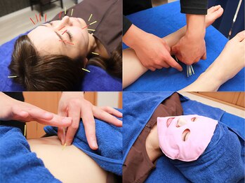鍼灸整体院アレンジの写真/モデルも通う小顔と健康に特化した美容鍼灸◆顔と体に鍼をするから効果が違う【1周年CP★美容鍼灸¥5000】