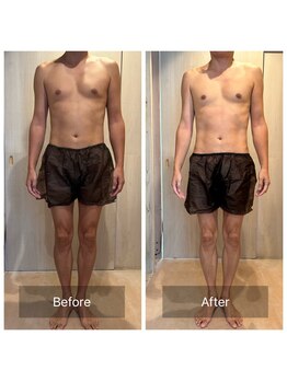 アリッチ 岡崎店(a.Rich)/ボディケア60分1回Before after!