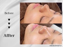 ホワイトラボ 梅田(White labo)/韓国ツヤ美肌☆オルチャン肌に♪