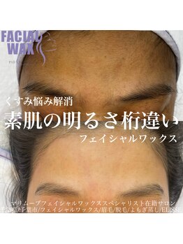 エリス(ELISSE)/くすみのお悩みが解消