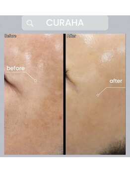 パールブルー(All Perl blue)/韓国の肌管理