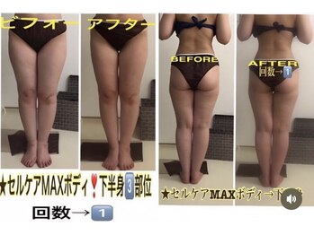 アルページュ(Arpege)/セルケアMAX 選ぶ上半身or下半身