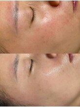 ユミサロン(U Mi Salon)/