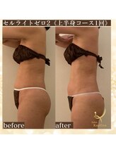 サロン カピリナ(salon Kapilina)/【before→after】