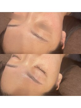 パピヨン(papillon)/ハリウッドブロウリフト【HBL】