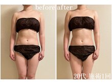 アビヤンガの雰囲気（施術1回で当日即寝落ち・超熟睡♪翌日には便通改善のお声も！）