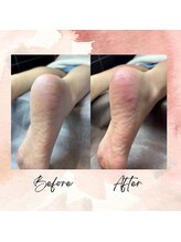 ビューティーサロンエイト(Beauty Salon8)/フットケアでかかと美人