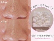 モエラビューティーサロン(Moela beauty salon)