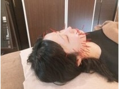 アキュティ 吉祥寺(Acuty)の写真