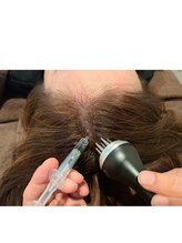 マジョラボ(Majo Labo.)/発育促進頭皮ケア♪