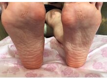 ビサンテ サロン/魚の目・たこならビサンテへ！