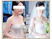 凛&美 銀座/8回施術のビフォーアフター