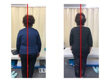 浜町しあわせ整体院/身体の歪み