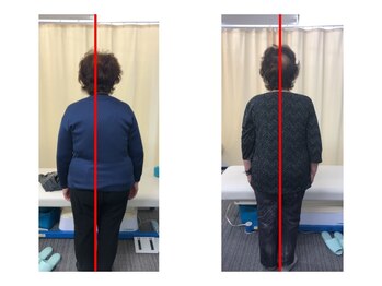 浜町しあわせ整体院/身体の歪み