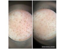 メナードフェイシャルサロン 愛知学院大学西の雰囲気(頑固な毛穴汚れも撃退◎)