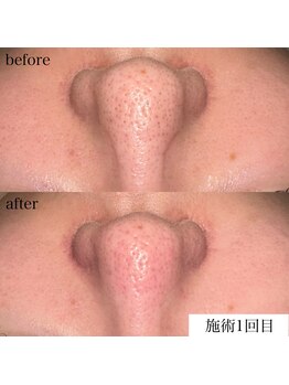 エフイチキュウサン(f.193)/ビフォーアフター