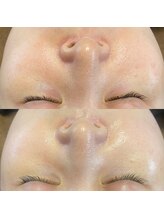 プレジール(Plaisir)/バクテリウムピール