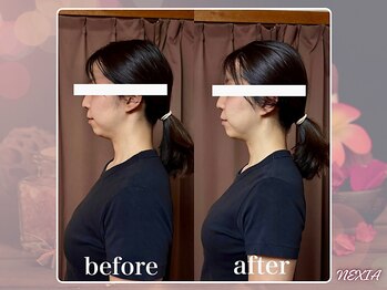 ネクシア 恵比寿(NEXIA EBISU)/頭皮ほぐしでフェイスライン変化