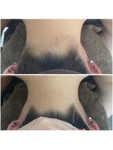 ミース 北九州店/うなじ◎ビフォーアフター