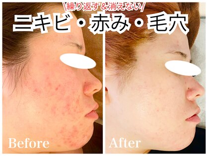 ノア 新宿(Noa)の写真