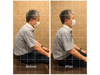 トラスト整体院 小池院/50代/男性/営業職/五十肩