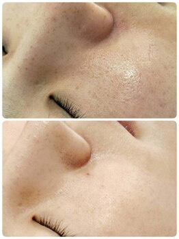 縁(en)の写真/話題の韓国美容!エステポテンツァ導入★選べる美容液で肌悩みを根本から改善し、理想の艶肌へ*