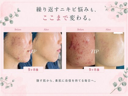 サロンサイ(salonsai)の写真